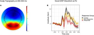 Neural Markers of Methylphenidate Response in Children With Attention Deficit Hyperactivity Disorder